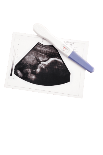ecografia in gravidanza